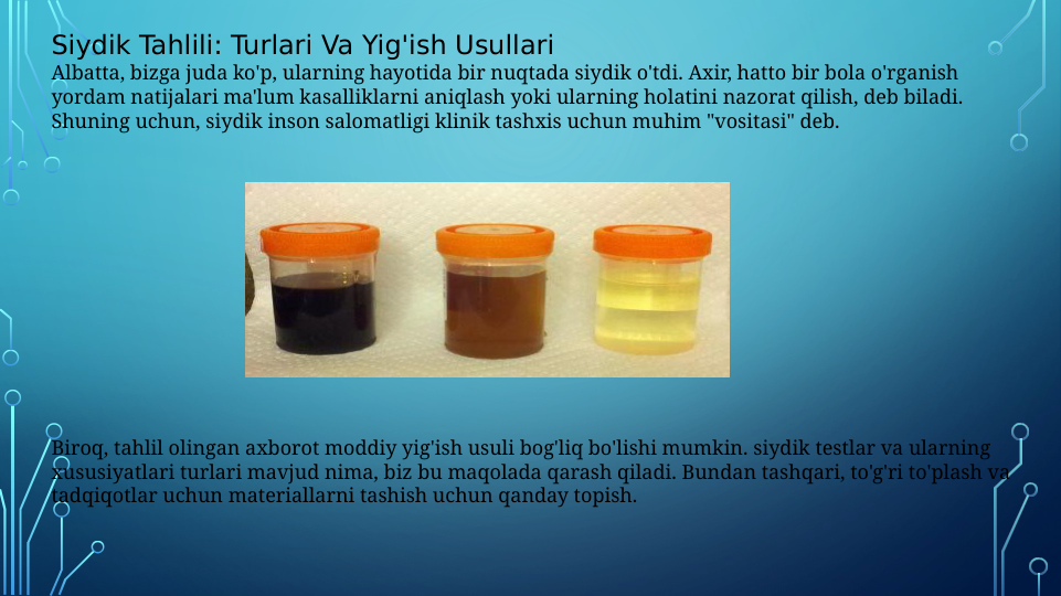  
                                                                                   
Siydik Tahlili: Turlari Va Yig'ish Usullari
Albatta, bizga juda ko'p, ularning hayotida bir nuqtada siydik o'tdi. Axir, hatto bir bola o'rganish 
yordam natijalari ma'lum kasalliklarni aniqlash yoki ularning holatini nazorat qilish, deb biladi. 
Shuning uchun, siydik inson salomatligi klinik tashxis uchun muhim "vositasi" deb.
                                                                                                            
Biroq, tahlil olingan axborot moddiy yig'ish usuli bog'liq bo'lishi mumkin. siydik testlar va ularning 
xususiyatlari turlari mavjud nima, biz bu maqolada qarash qiladi. Bundan tashqari, to'g'ri to'plash va 
tadqiqotlar uchun materiallarni tashish uchun qanday topish.
