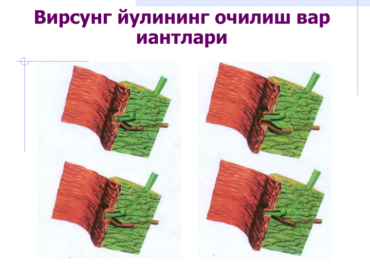 Вирсунг йулининг очилиш вар
иантлари
