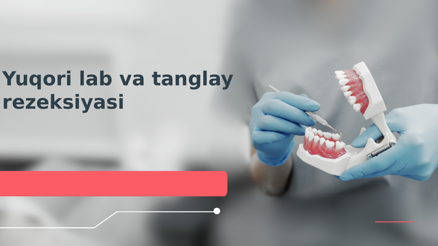 Yuqori lab va tanglay 
rezeksiyasi
