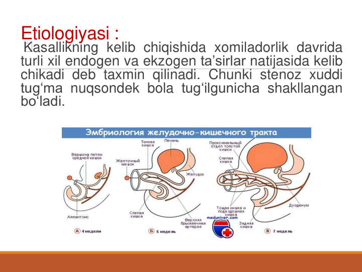 Etiologiyasi :
