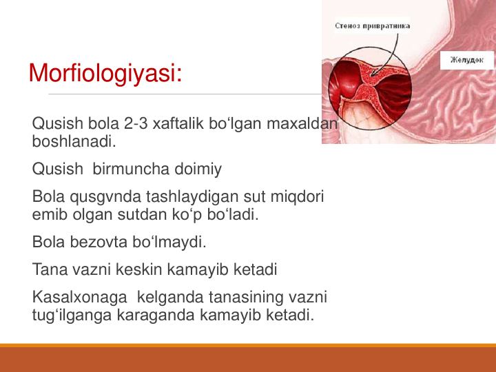 Morfiologiyasi:
Qusish bola 2-3 xaftalik bo‘lgan maxaldan 
boshlanadi.
Qusish  birmuncha doimiy
Bola qusgvnda tashlaydigan sut miqdori 
emib olgan sutdan ko‘p bo‘ladi.
Bola bezovta bo‘lmaydi.
Tana vazni keskin kamayib ketadi
Kasalxonaga  kelganda tanasining vazni 
tug‘ilganga karaganda kamayib ketadi.
