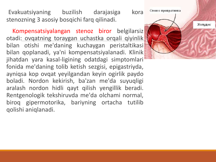 Evakuatsiyaning
buzilish
darajasiga
kora
stenozning 3 asosiy bosqichi farq qilinadi.
Kompensatsiyalangan
stenoz
biror
belgilarsiz
otadi: ovqatning toraygan uchastka orqali qiyinlik
bilan otishi me'daning kuchaygan peristaltikasi
bilan qoplanadi, ya'ni kompensatsiyalanadi. Klinik
jihatdan yara kasal-ligining odatdagi simptomlari
fonida me'daning tolib ketish sezgisi, epigastriyda,
ayniqsa kop ovqat yeyilgandan keyin ogirlik paydo
boladi. Nordon kekirish, ba'zan me'da suyuqligi
aralash nordon hidli qayt qilish yengillik beradi.
Rentgenologik tekshiruvda me'da olchami normal,
biroq
gipermotorika,
bariyning
ortacha
tutilib
qolishi aniqlanadi.
