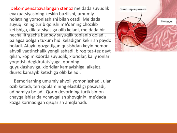 Dekompensatsiyalangan stenoz me'dada suyuqlik
evakuatsiyasining keskin buzilishi, umumiy
holatning yomonlashishi bilan otadi. Me'dada
suyuqlikning turib qolishi me'daning chozilib
ketishiga, dilatatsiyasiga olib keladi, me'dada bir
necha litrgacha badboy suyuqlik toplanib qoladi, 
palagsa bolgan tuxum hidi keladigan kekirish paydo
boladi. Atayin qozgatilgan qusishdan keyin bemor
ahvoli vaqtinchalik yengillashadi, biroq tez-tez qayt
qilish, kop mikdorda suyuqlik, xloridlar, kaliy ionlari
yoqotish degidratatsiyaga, qonning
quyuklashuviga, xloridlar kamayishiga, alkaloz, 
diurez kamayib ketishiga olib keladi.
Bemorlarning umumiy ahvoli yomonlashadi, ular
ozib ketadi, teri qoplamining elastikligi pasayadi, 
adinamiya boladi. Qorin devorining turtkisimon
chayqalishlarida «chayqalish shovqini», me'dada
kozga korinadigan qisqarish aniqlanadi.
