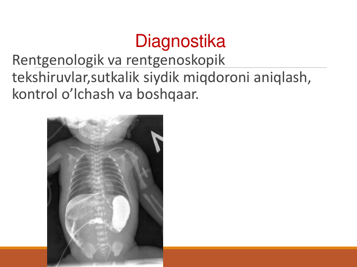 Diagnostika
Rentgenologik va rentgenoskopik
tekshiruvlar,sutkalik siydik miqdoroni aniqlash, 
kontrol o’lchash va boshqaar.
