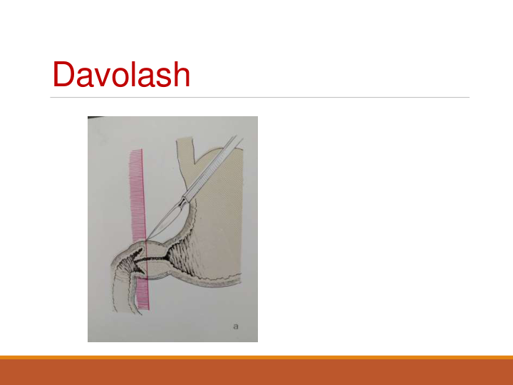 Davolash
