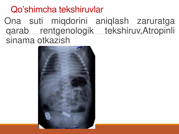 Qo’shimcha tekshiruvlar
Ona
suti
miqdorini
aniqlash
zaruratga
qarab
rentgenologik
tekshiruv,Atropinli
sinama otkazish
