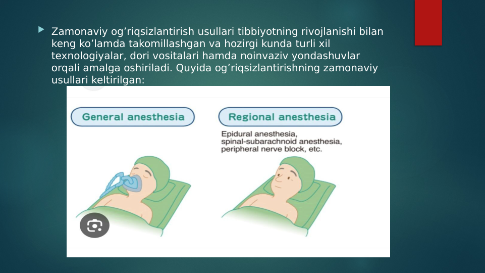  Zamonaviy og’riqsizlantirish usullari tibbiyotning rivojlanishi bilan 
keng ko’lamda takomillashgan va hozirgi kunda turli xil 
texnologiyalar, dori vositalari hamda noinvaziv yondashuvlar 
orqali amalga oshiriladi. Quyida og’riqsizlantirishning zamonaviy 
usullari keltirilgan:
