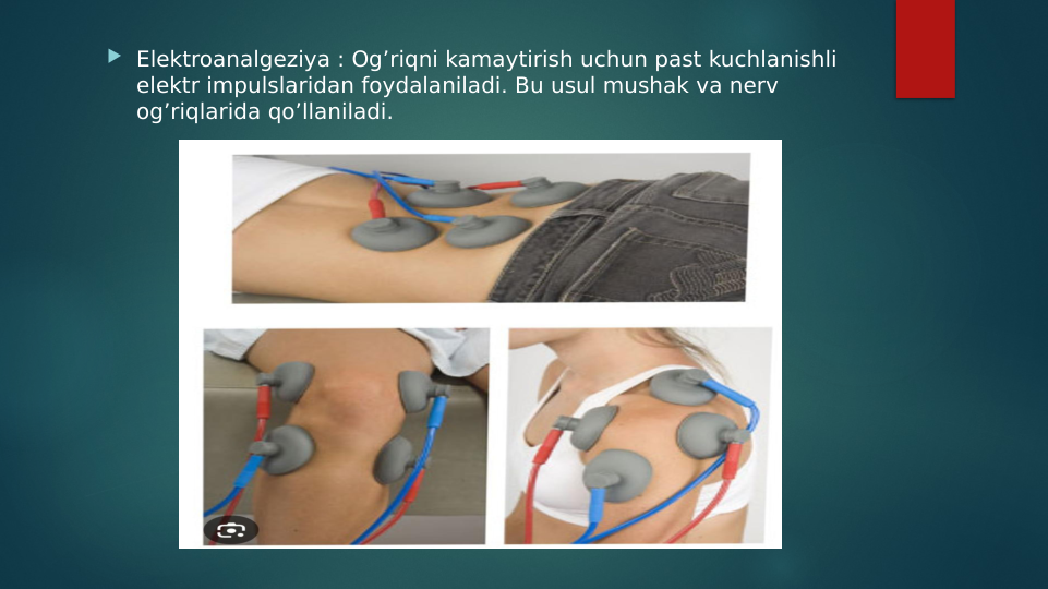 Elektroanalgeziya : Og’riqni kamaytirish uchun past kuchlanishli 
elektr impulslaridan foydalaniladi. Bu usul mushak va nerv 
og’riqlarida qo’llaniladi.
